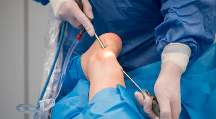 Cirugía Articular